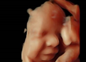 El Hospital Quirónsalud Valle del Henares incorpora un nuevo ecógrafo con tecnología 5 D