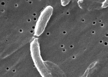 Castilla-La Mancha declara el primer caso de cólera en España desde 1979