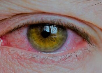 El Hospital Universitario Infanta Elena pone en marcha un servicio especializado para el abordaje de las uveítis