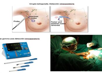 El Hospital Universitario La Luz incorpora Sonda Gamma intraoperatoria de última generación para cirugía radioguiada oncológica