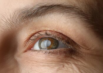 Olympia dispone de los procedimientos menos invasivos en cirugía de glaucoma