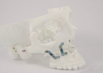 Cirugía ortognática para corregir las anomalías de la mandíbula