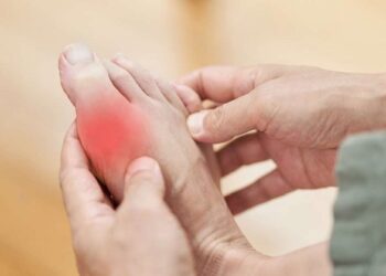 La ecografía articular favorece el diagnóstico temprano de la gota