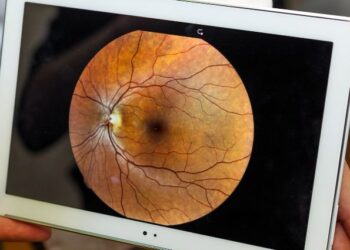 “Toda la población está expuesta a sufrir glaucoma; no es solo una enfermedad hereditaria”