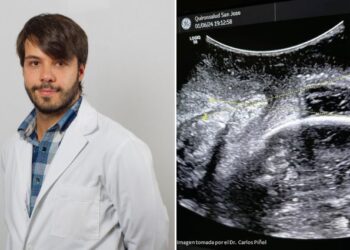 La ecografía intraparto, una herramienta fundamental en los partos complejos