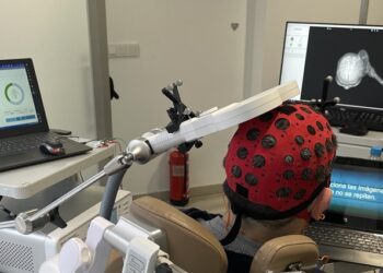 Olympia Quirónsalud lidera la revolución médica con su Unidad de Neuromodulación Cerebral no invasiva