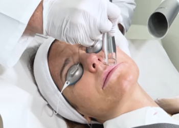 La revolución en rejuvenecimiento: el innovador láser frío que transforma la piel en una sola sesión